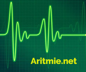 Aritmie