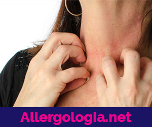 Allergologia