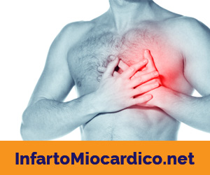 Infarto miocardico
