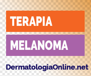 Terapia melanoma