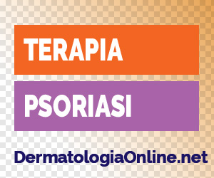 Terapia psoriasi