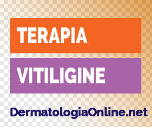 Terapia vitiligine